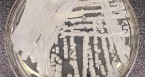 Jamur tahan narkoba dan ‘ancaman mendesak’ karena menyebar di rumah sakit Jamur tahan narkoba dan 'ancaman mendesak' karena menyebar di rumah sakit